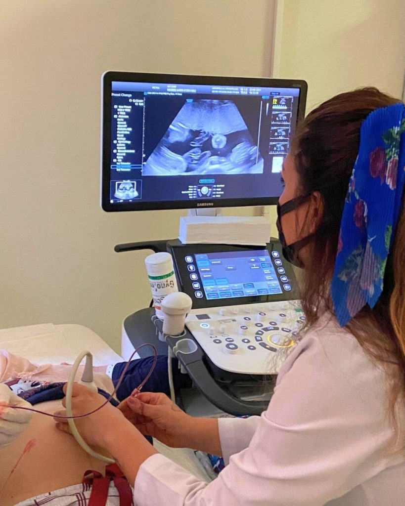 antalya detaylı ultrason