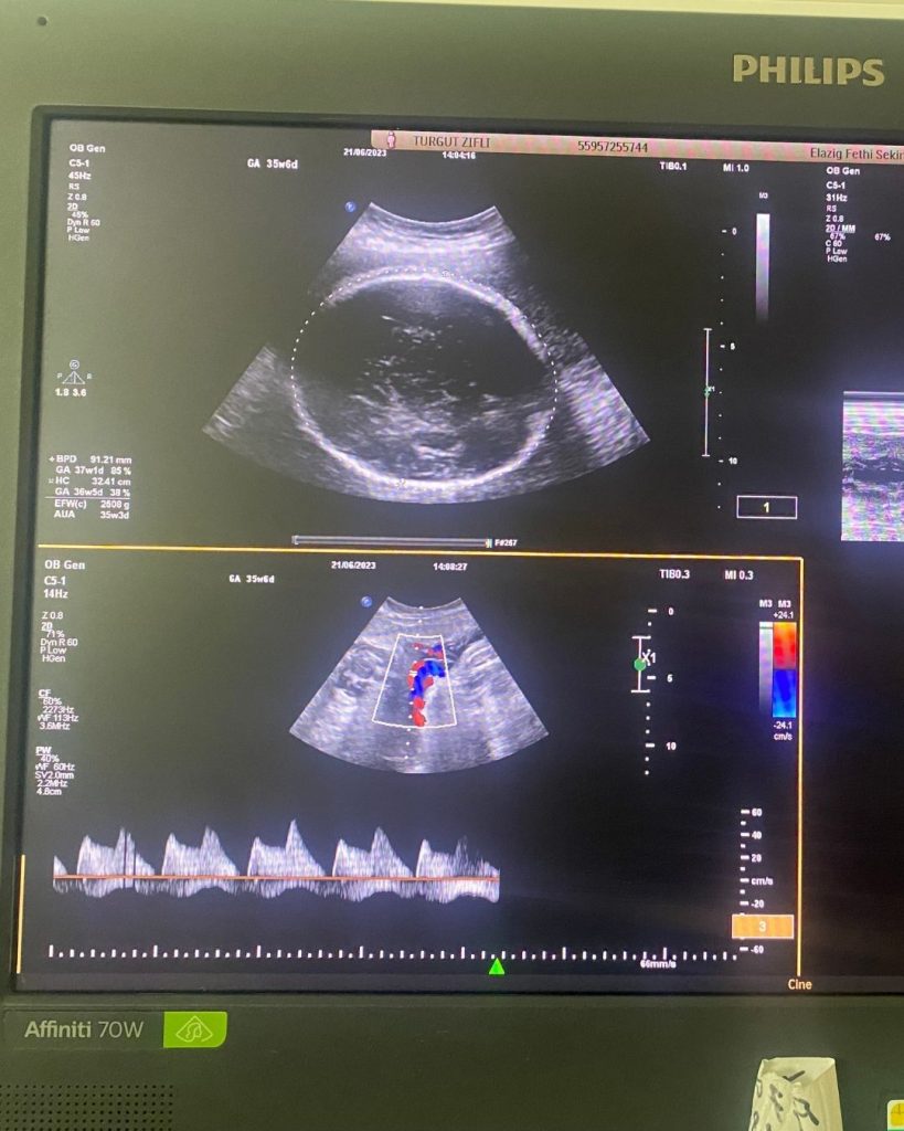 antalya gebelik takibi