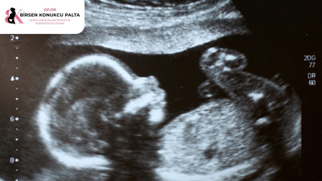 Antalya Ayrıntılı ultrason